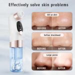 Electric Blackhead Remover Pore Vacuum - USB Rechargeable Water Cycle Facial Cleaner for Acne & Blackhead Removal