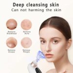 Electric Blackhead Remover Pore Vacuum - USB Rechargeable Water Cycle Facial Cleaner for Acne & Blackhead Removal